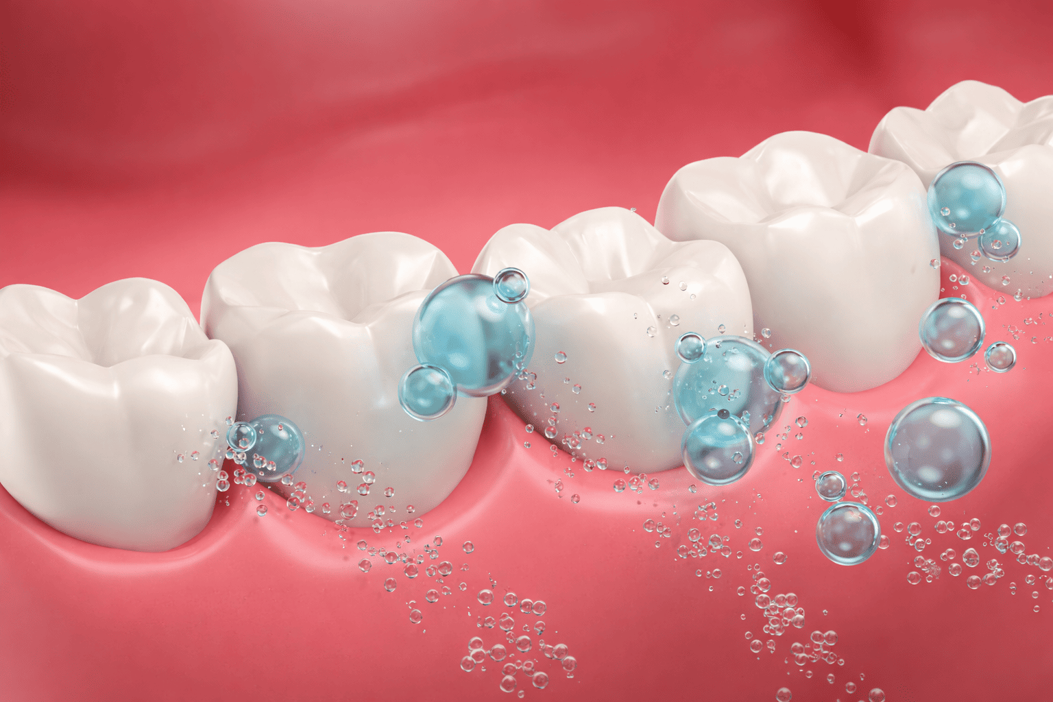 фторирование зубов